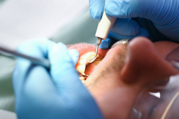 Best Emergency Dental Services for Seniors in Moulton, AL